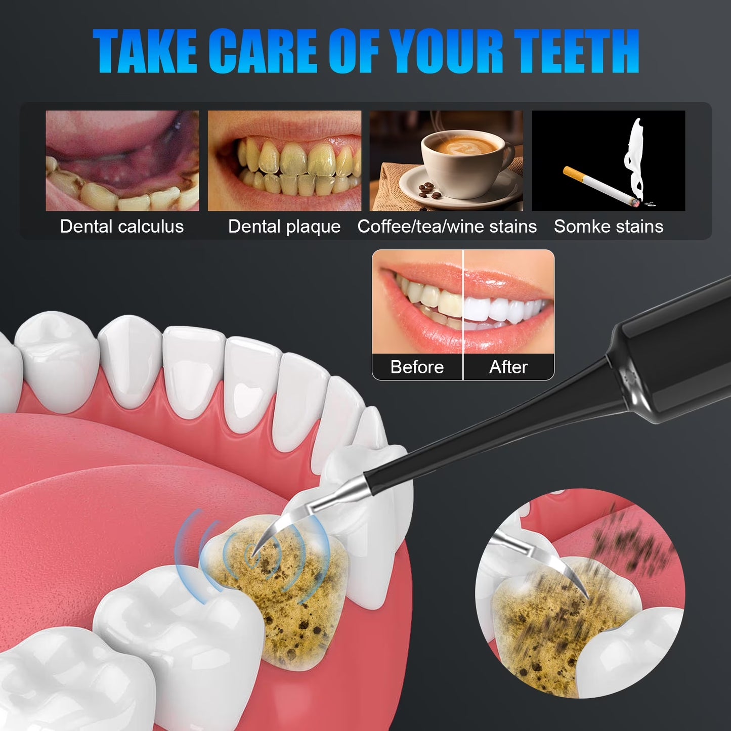 Electric Dental Calculus Remover for Adult Kids -  Dental Calculus Remover Teeth Cleaning Kit with 6 Adjustable Modes, Black